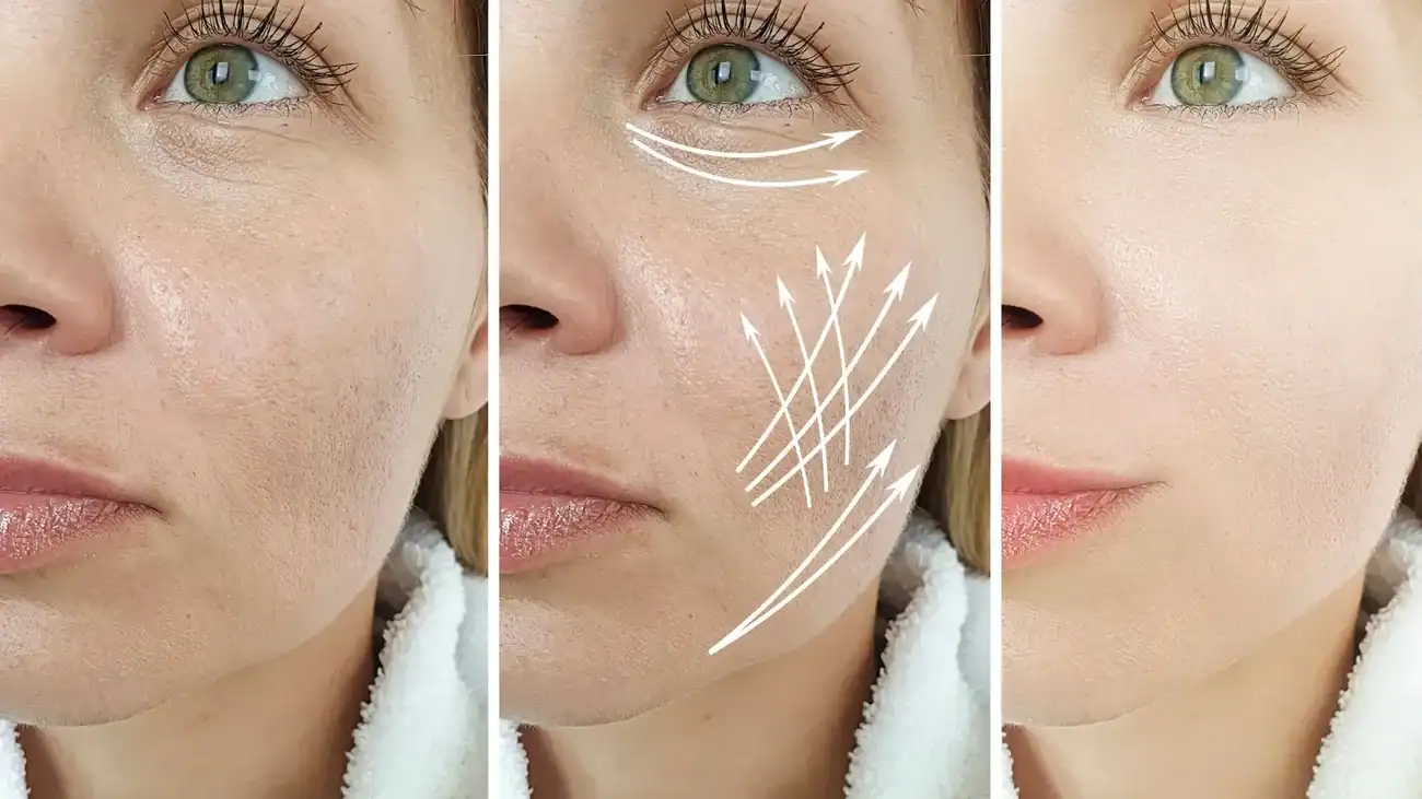 Can One Treatment Really Tackle More Than One Skin Concern Olney?