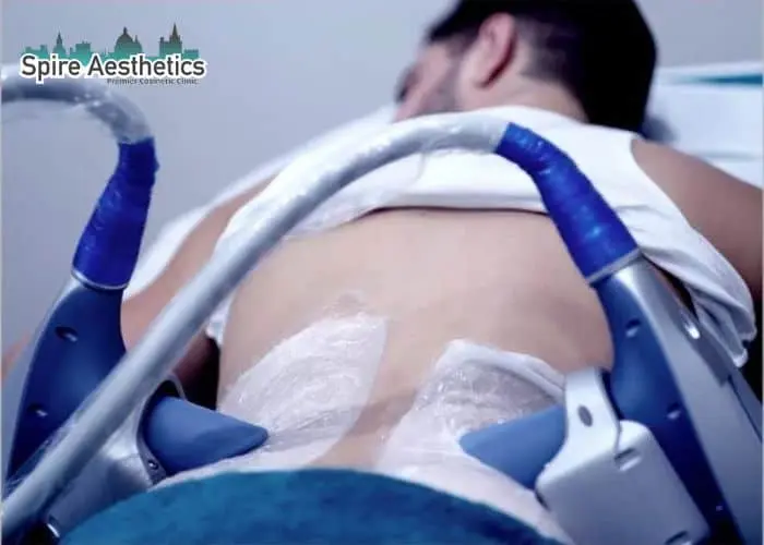 Man having fat freezing treatment done on love handles before a competitions Olney to create a sculpted look.