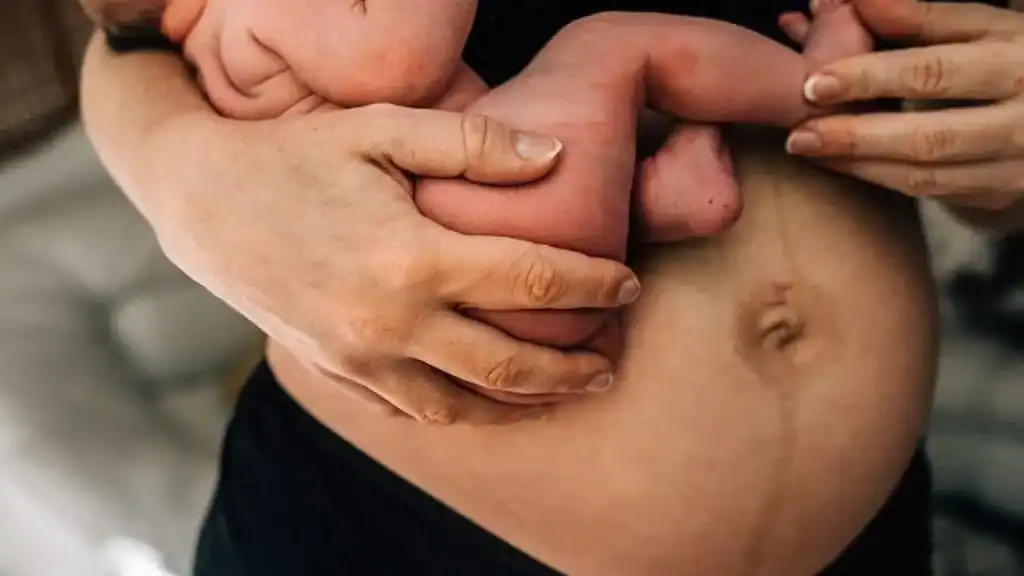 Why Is My Stomach Still Big After Pregnancy Olney?
